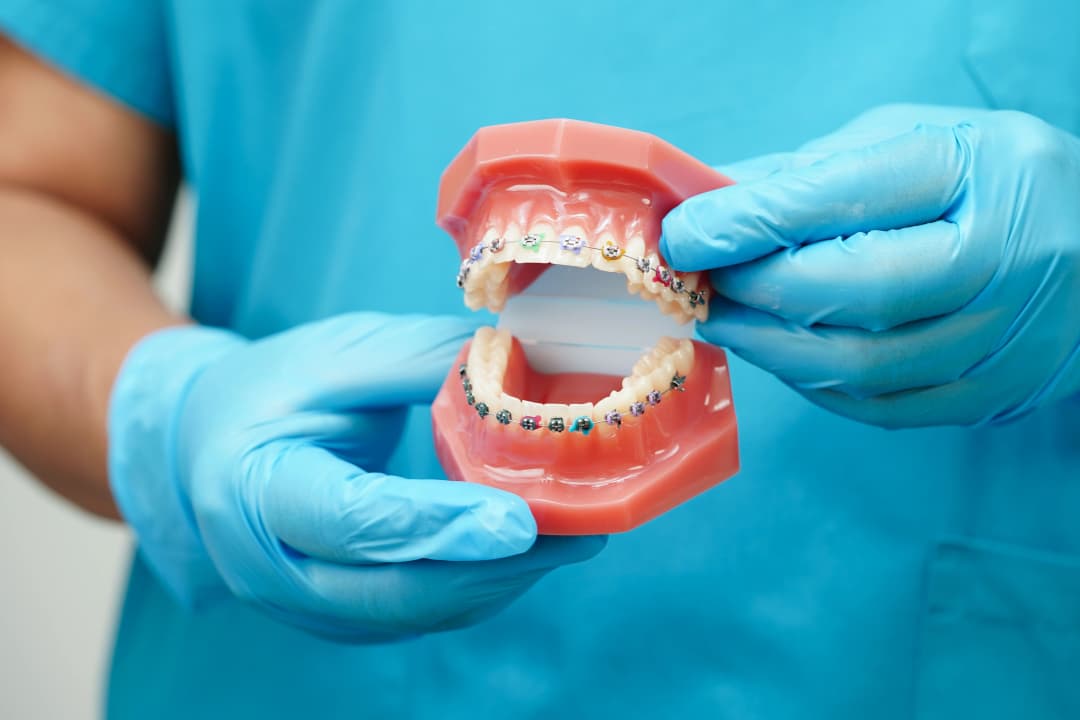 Orthodontic Treatment