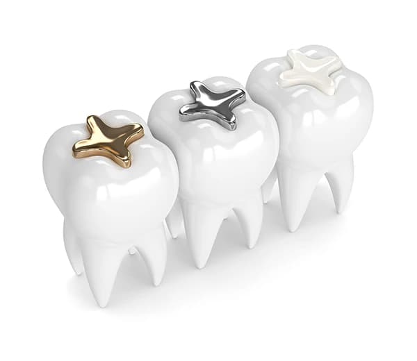 Fillings
